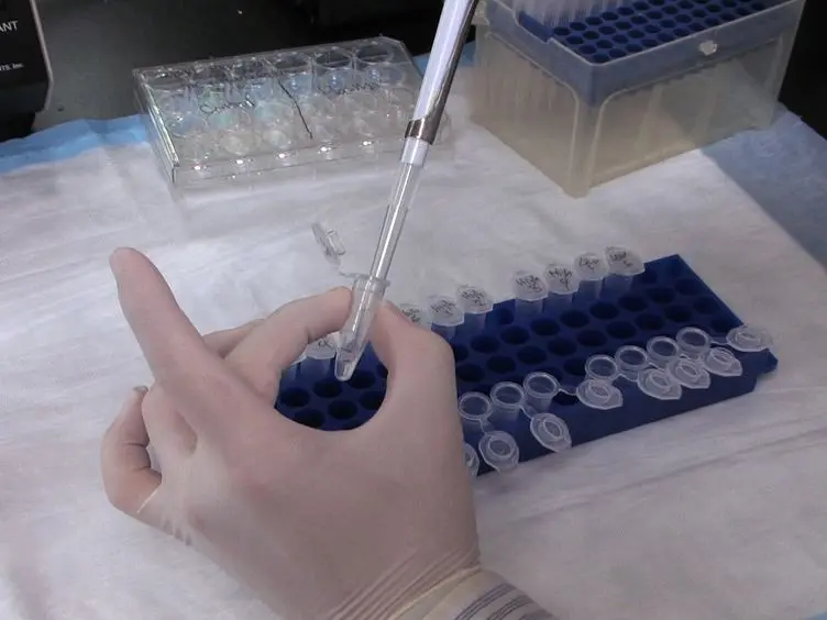 JoVE Research Video for Coculture Analysis of Extracellular Protein Interactions Affecting Insulin Secretion by Pancreatic Beta Cells