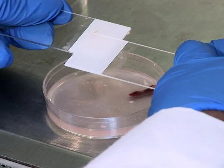 JoVE Research Video for Isolation and Th17 Differentiation of Naïve CD4 T Lymphocytes