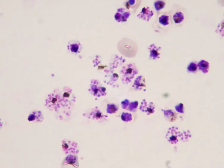 JoVE Research Video for High Yield Purification of Plasmodium falciparum Merozoites For Use in Opsonizing Antibody Assays