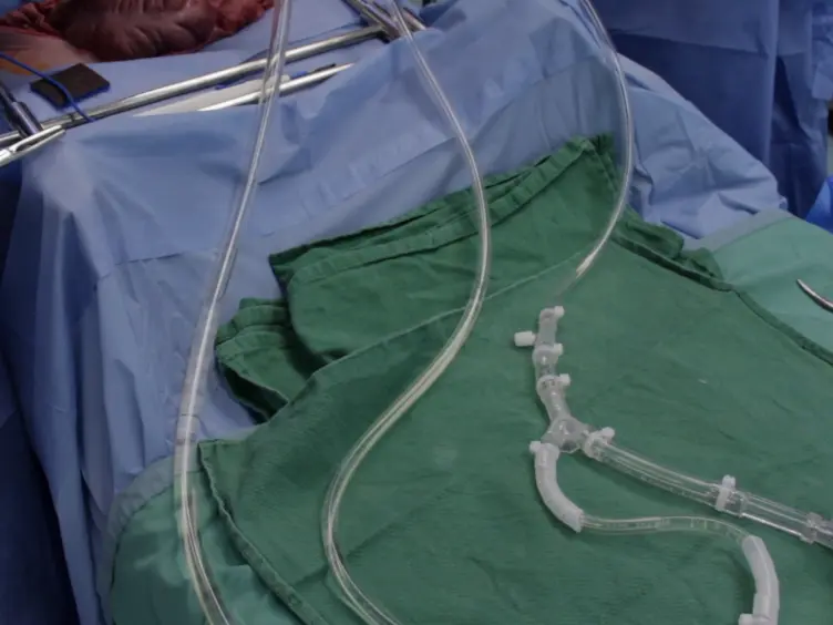 JoVE Research Video for Technique of Porcine Liver Procurement and Orthotopic Transplantation using an Active Porto-Caval Shunt