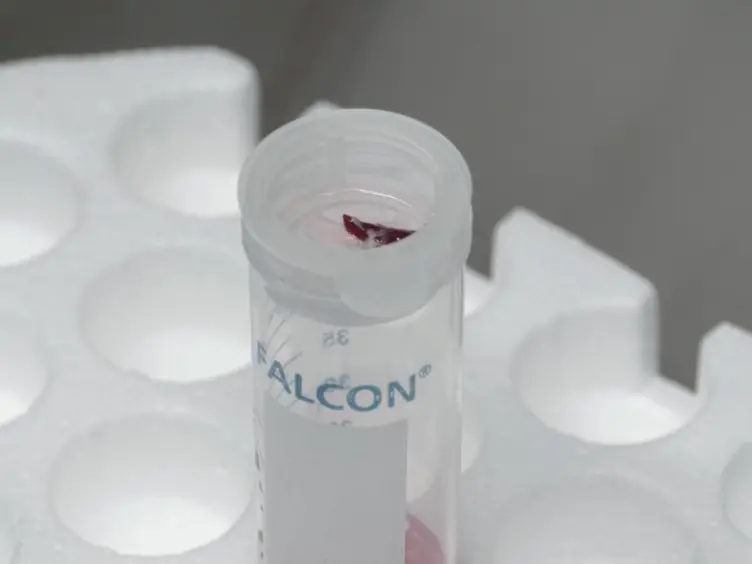 JoVE Research Video for Generation of CAR T Cells for Adoptive Therapy in the Context of Glioblastoma Standard of Care