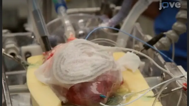 JoVE Research Video for Testing the Efficacy of Pharmacological Agents in a Pericardial Target Delivery Model in the Swine