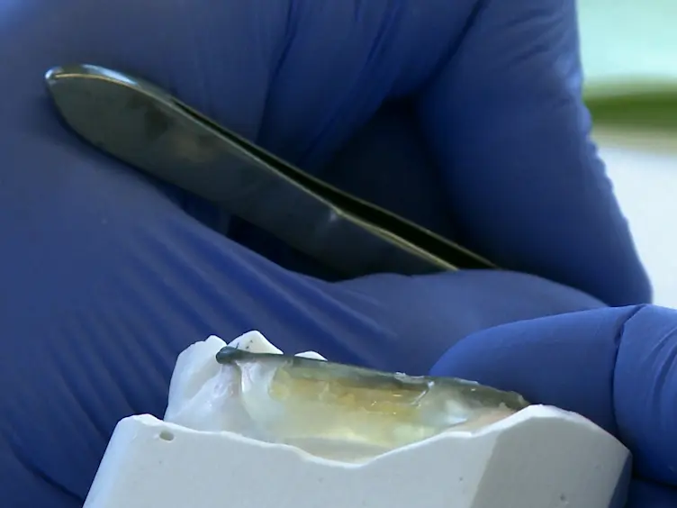 JoVE Research Video for Ratiometric Imaging of Extracellular pH in Dental Biofilms