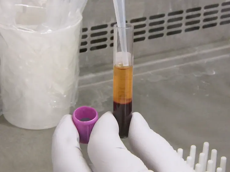 JoVE Research Video for Targeted Next-generation Sequencing and Bioinformatics Pipeline to Evaluate Genetic Determinants of Constitutional Disease