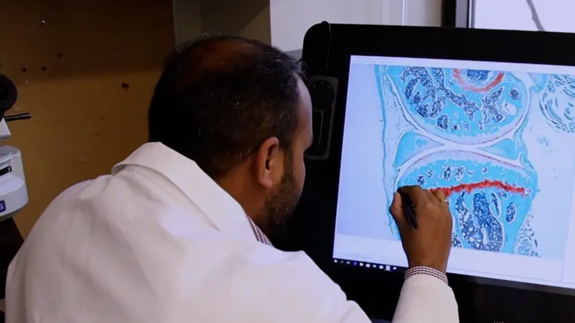 JoVE Research Video for Standardized Histomorphometric Evaluation of Osteoarthritis in a Surgical Mouse Model