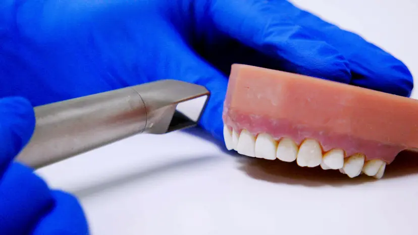 JoVE Research Video for Detection and Removal of Tooth-Colored Composite Resin Using the Fluorescence-Aided Identification Technique