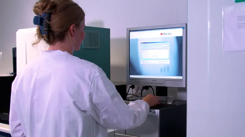 JoVE Research Video for Ex Vivo Release of Calcitonin Gene-Related Peptide from the Trigeminovascular System in Rodents