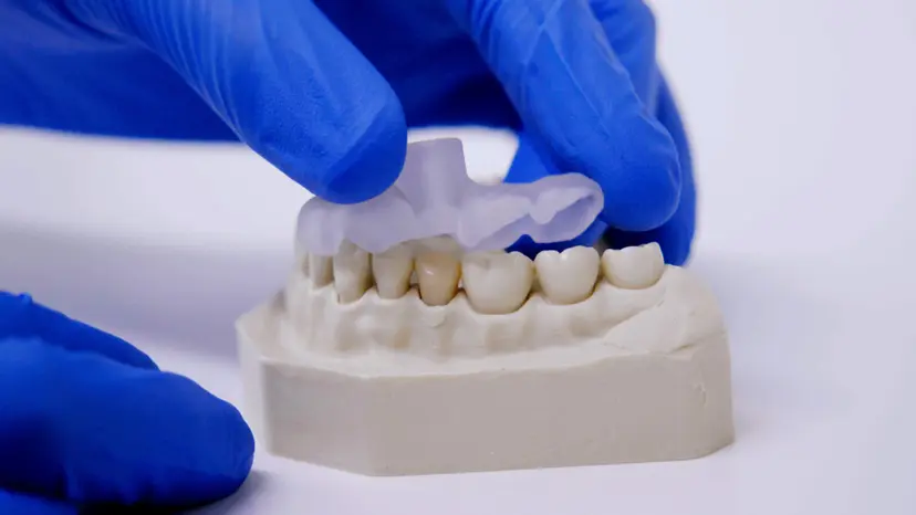 JoVE Research Video for Guided Endodontics: Three-Dimensional Planning and Template-Aided Preparation of Endodontic Access Cavities