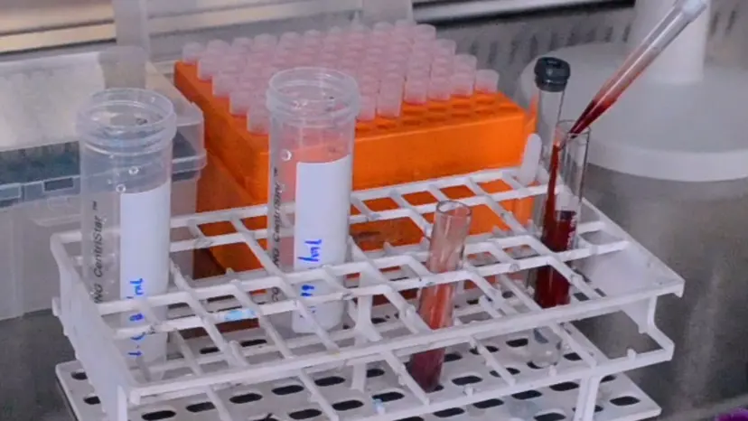 JoVE Research Video for Morphological and Compositional Analysis of Neutrophil Extracellular Traps Induced by Microbial and Chemical Stimuli