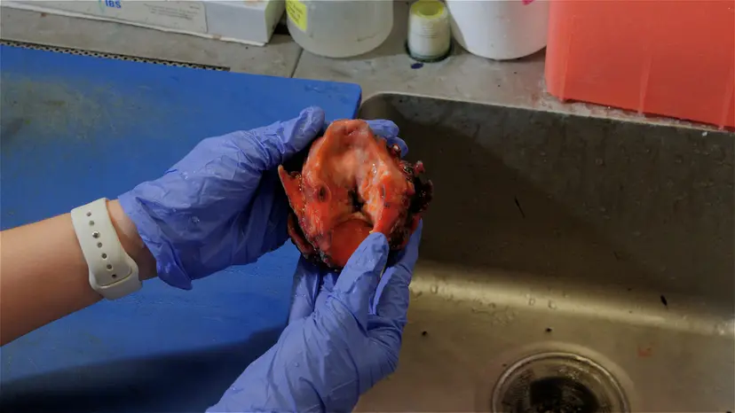 JoVE Research Video for Enhanced Communication of Tumor Margins Using 3D Scanning and Mapping
