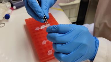 Enzymatic Isolation of Skeletal Muscle Interstitial Extracellular Vesicles