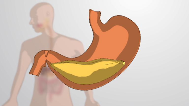 What is Monogastric Digestion?