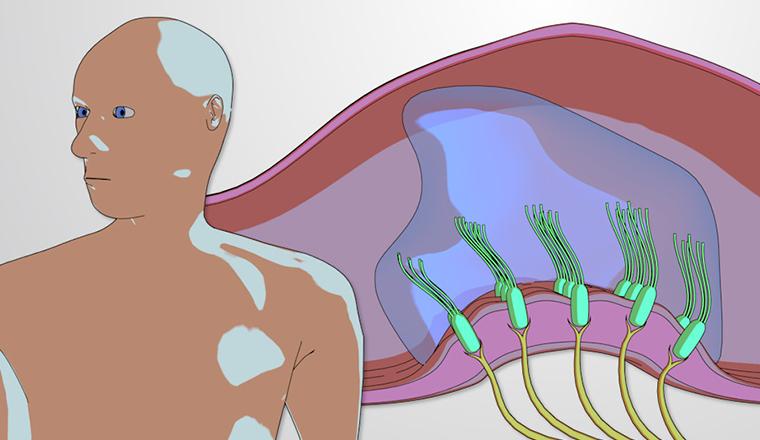 The Vestibular System