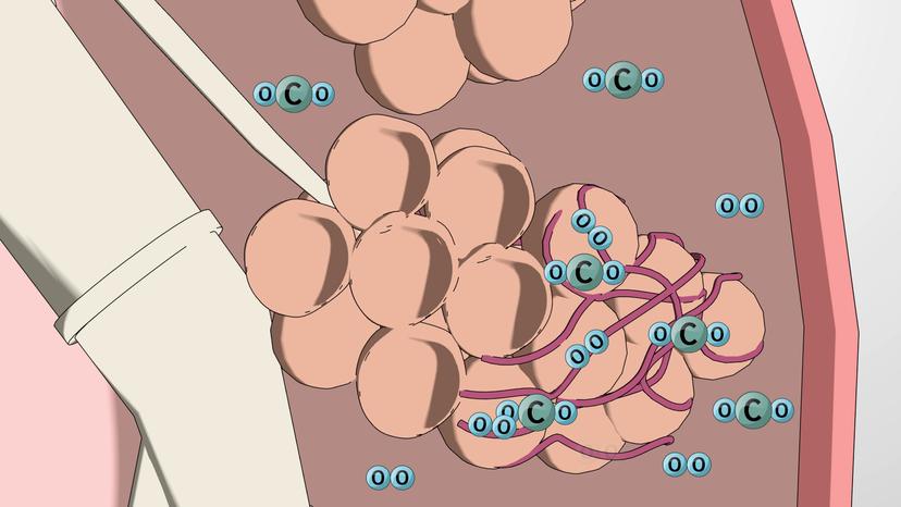 Gas Exchange and Transport