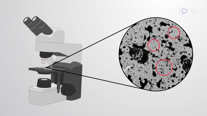 Euchromatin