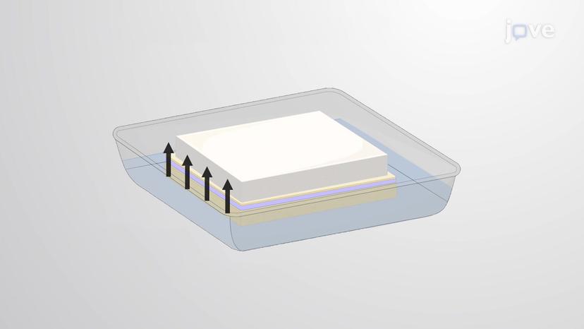 Southern Blot