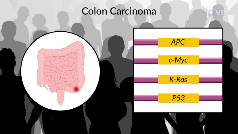 Cancers Originate from Somatic Mutations in a Single Cell