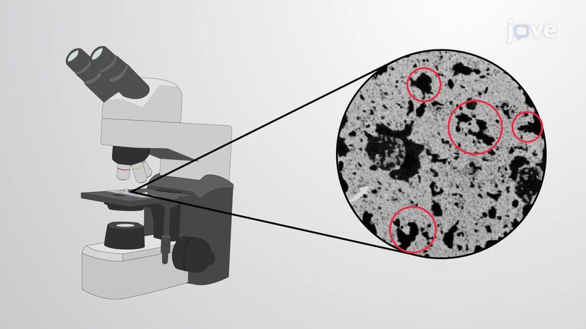 Heterochromatin