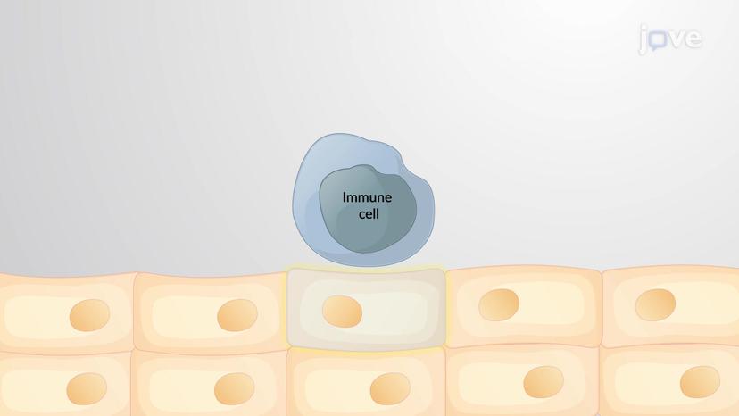 The Extrinsic Apoptotic Pathway