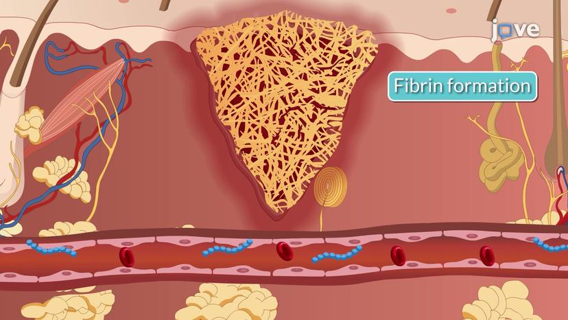 Inflammatory Response II: Inflammatory Exudate and Tissue Repair