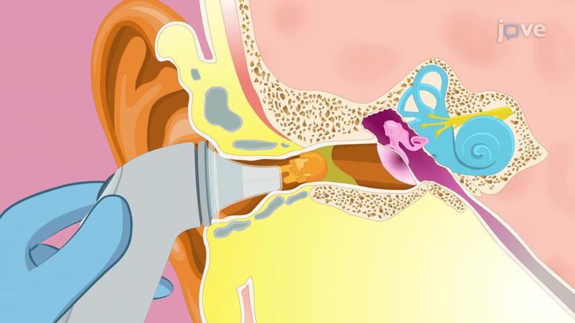 Assessing Body Temperature - Tympanic membrane