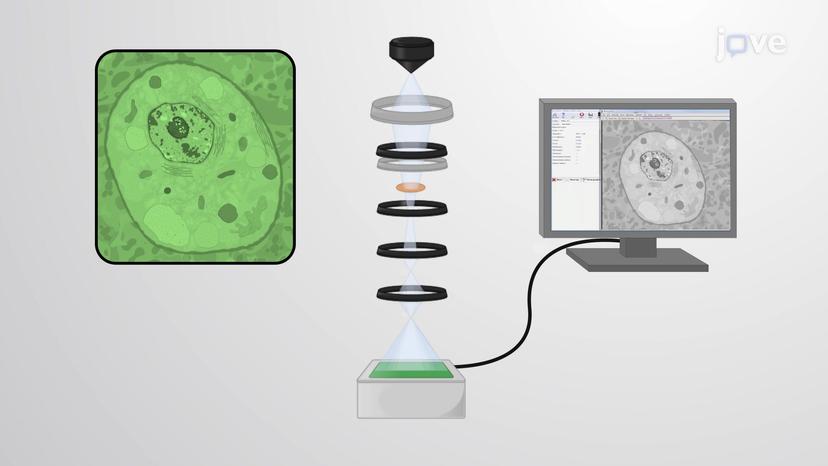 Transmission Electron Microscopy