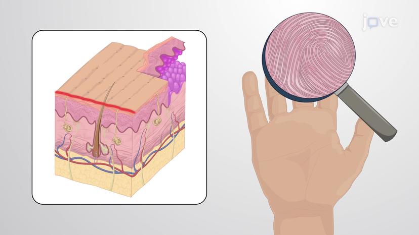 Papillary Dermis