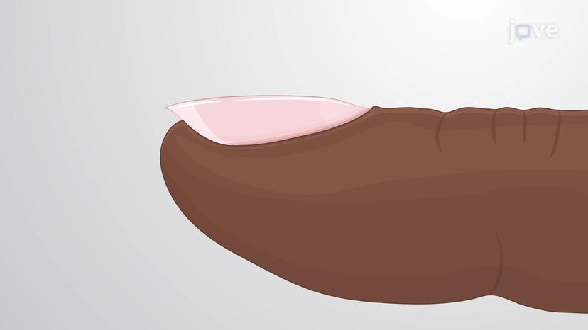 Accessory Structures of the Skin: Nails