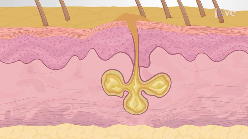 Accessory Structures of the Skin: Sebaceous Glands