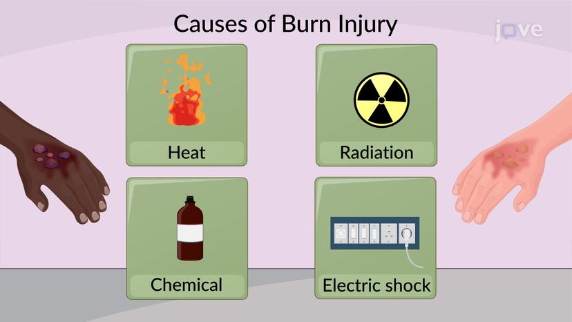 Burn Injuries