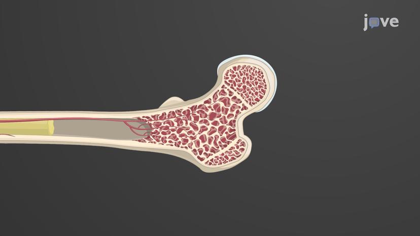 Gross Anatomy of Bone