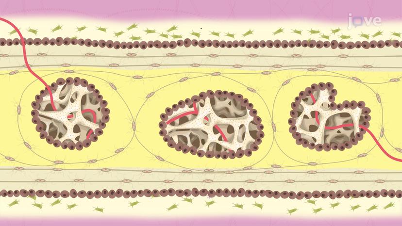 Bone Formation by Intramembranous Ossification