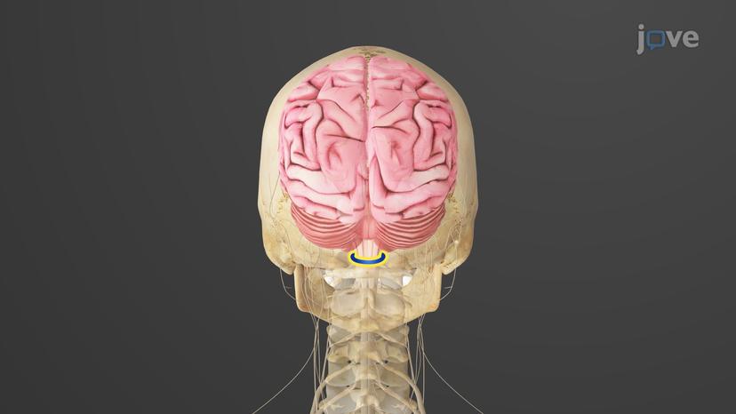 Cranial Bones: Superior and Posterior View