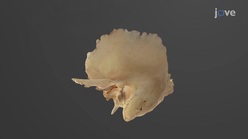 Cranial Bones: Lateral View
