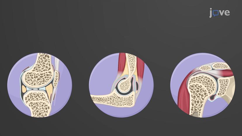 Functional Classification of Joints