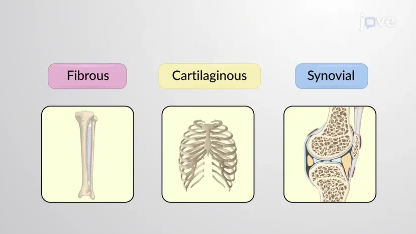 Structural Classification of Joints