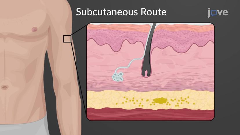 Routes of Drug Administration: Parenteral