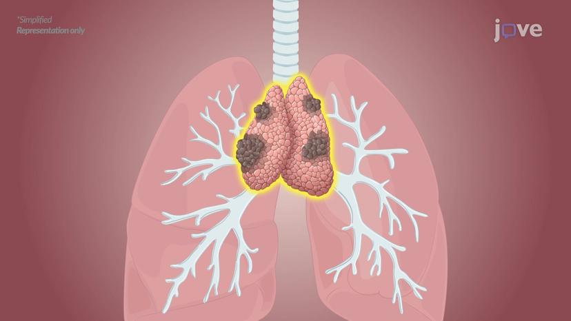 Myasthenia Gravis: Overview and Treatment