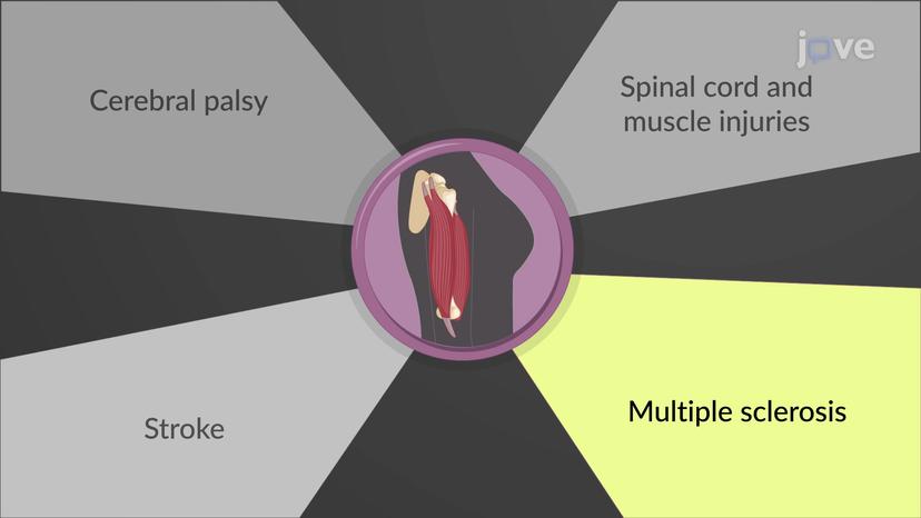 Centrally Acting Muscle Relaxants: Therapeutic Uses