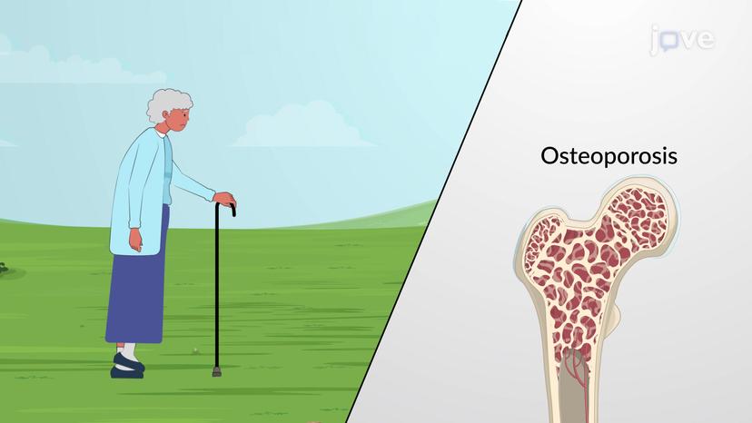 Role of Vitamins in Maintaining Bone Health