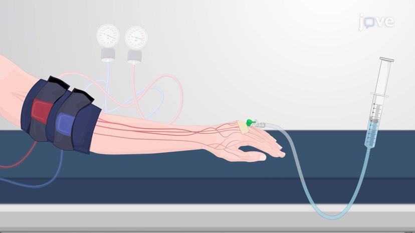 Local Anesthetics: Clinical Application as Intravenous Regional Anesthesia