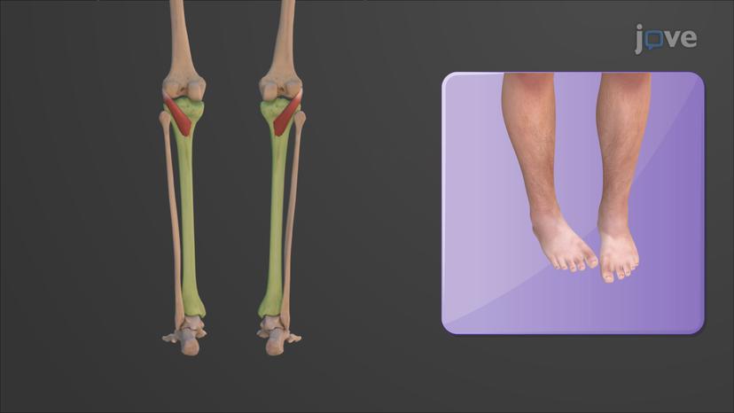 Muscles of the Leg that Move the Foot and Toes