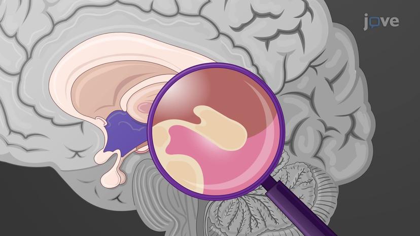 Diencephalon: Anatomical Regions