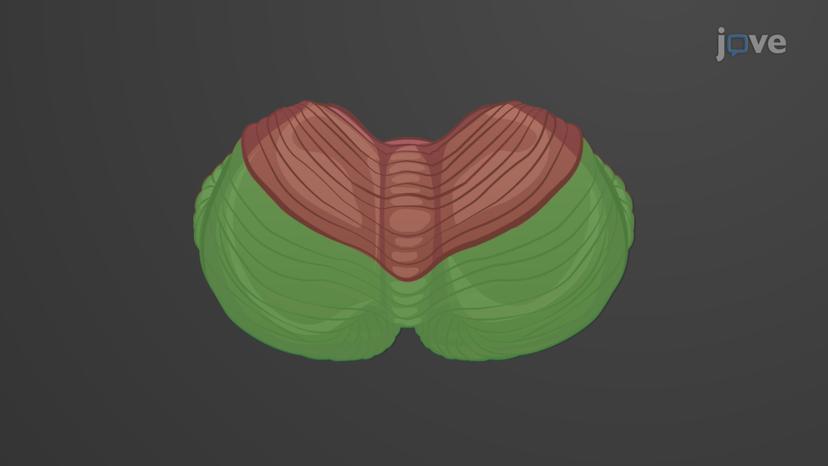 Cerebellum: Anatomical Regions