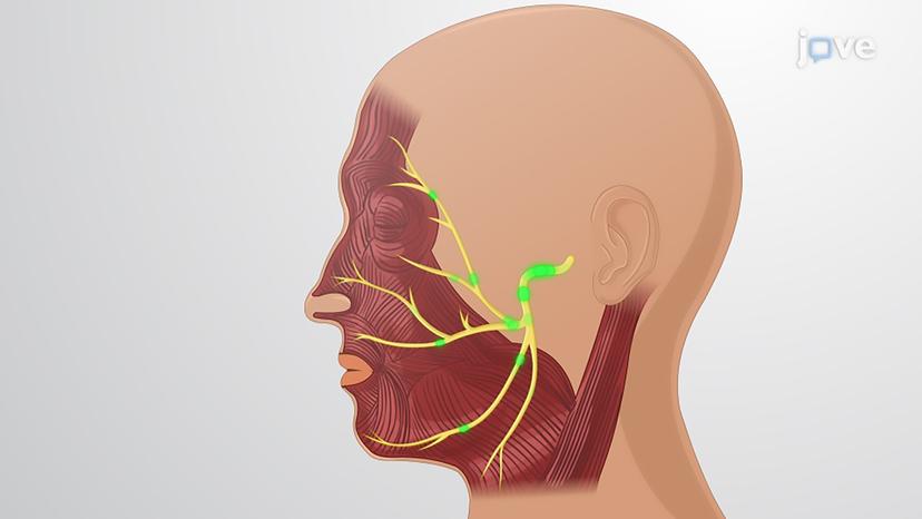 Cranial Nerves: Types Part II