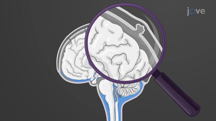 Cerebrospinal Fluid