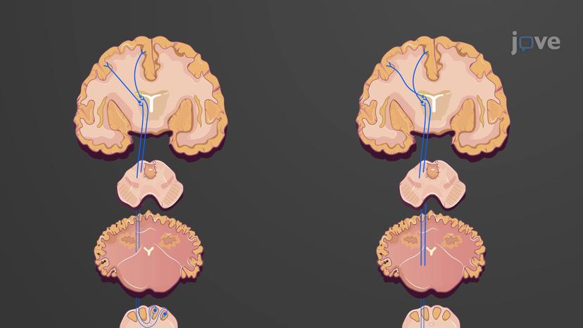 Overview of Somatic Sensory Pathways