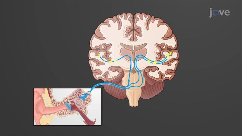 Auditory Pathway