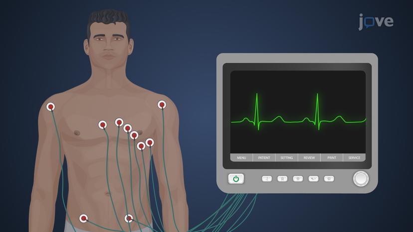 Mechanism of Cardiac Arrhythmias