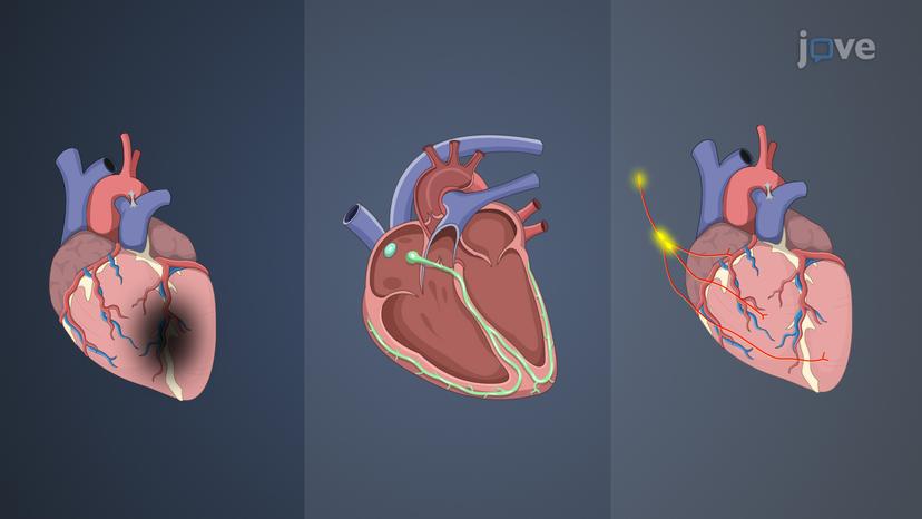 Pathophysiology of Cardiac Performance